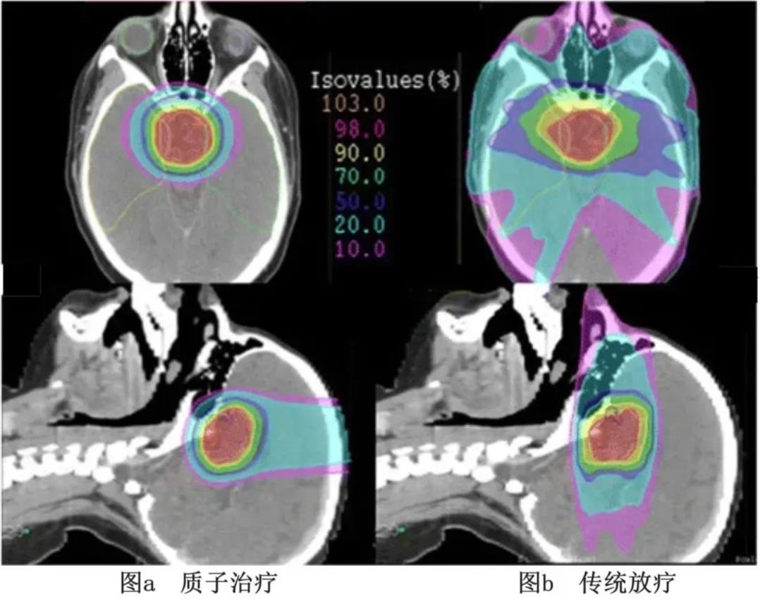 抗癌有效率高达97%!肿瘤绿色治疗大幅提高生存质量!不仅要治得好,还要副作用少!