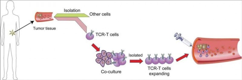 TCRT细胞疗法的治疗流程