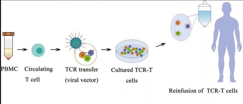 TCR-T细胞疗法治疗流程