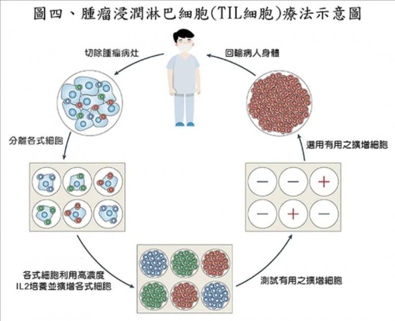 TIL细胞疗法治疗流程