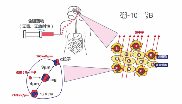 难治的稀有突变型就要用“特效药”!我国自主研发JMT-101再战非小细胞肺癌