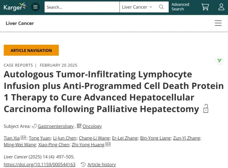 无癌生存4年!国研全球首创TIL三联疗法划时代攻克肝癌!还可惠及肺癌、乳腺癌、宫颈癌等