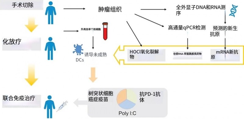 胶质母细胞瘤的治疗