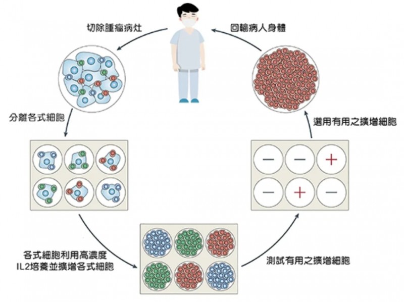 TIL疗法治疗过程示例图