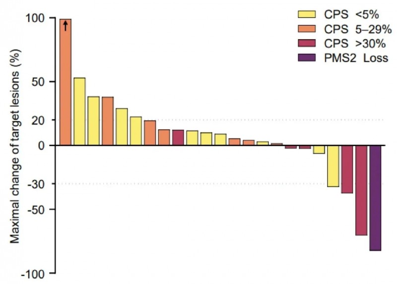 SMT-NK联合帕博利珠单抗治疗胆道癌的疾病控制率
