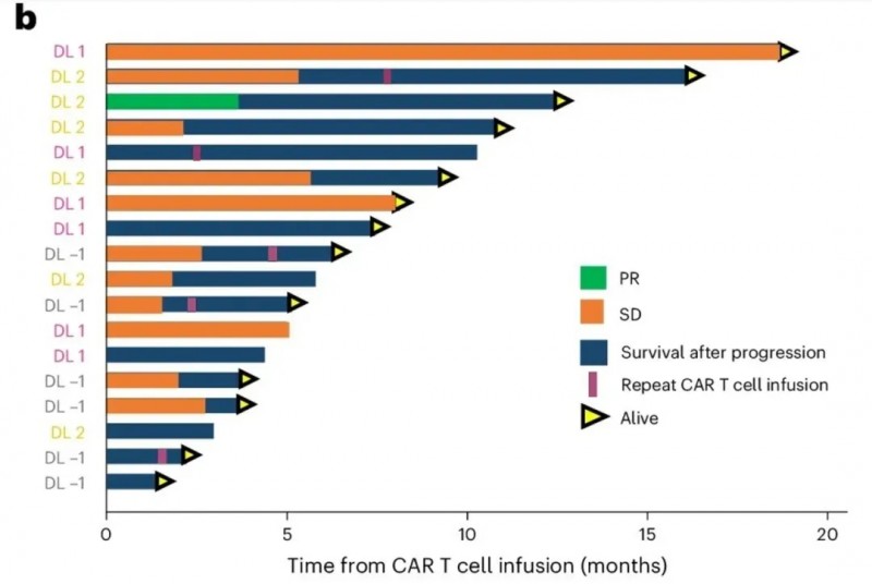 双靶点CAR-T治疗胶质母细胞瘤的生存期
