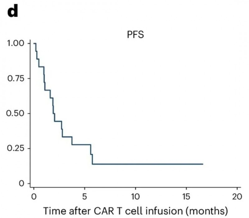 双靶点CAR-T治疗胶质母细胞瘤的中位无进展生存期