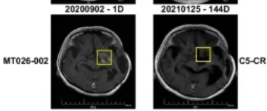 难治的稀有突变型就要用“特效药”！我国自主研发JMT-101再战非小细胞肺癌