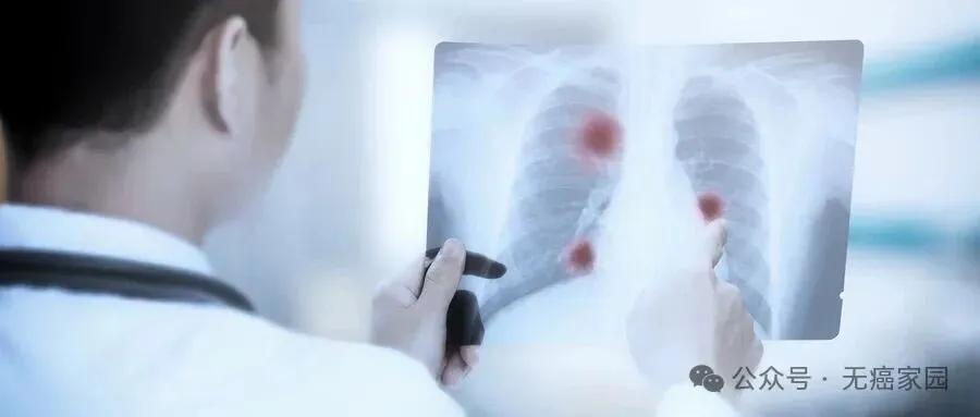 难治的稀有突变型就要用“特效药”！我国自主研发JMT-101再战非小细胞肺癌