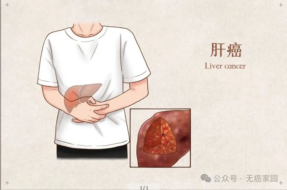 难治的稀有突变型就要用“特效药”！我国自主研发JMT-101再战非小细胞肺癌