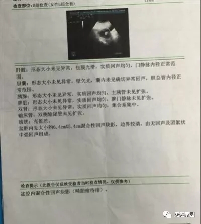 手术做一半没找到肿瘤,白挨一刀!第二诊疗意见对肿瘤患者有多重要! ​