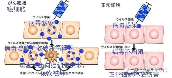 90%的肿瘤患者还不知道,日本竟然有这么多神奇的抗癌技术