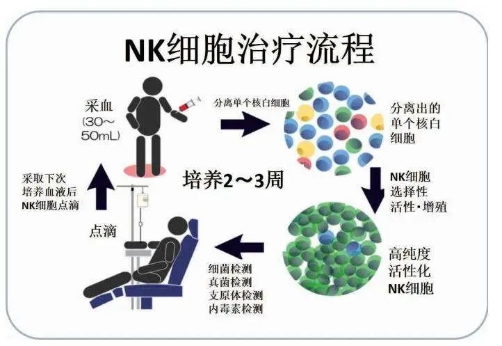 CAR-NK细胞治疗流程