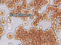 T细胞清除癌细胞