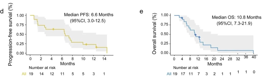 异基因NK细胞联合GS方案治疗胰腺癌的中卫无进展生存期