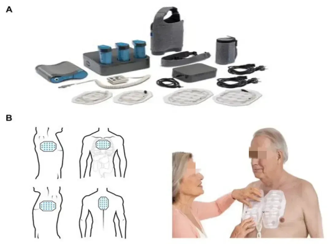 电场疗法治疗肺癌