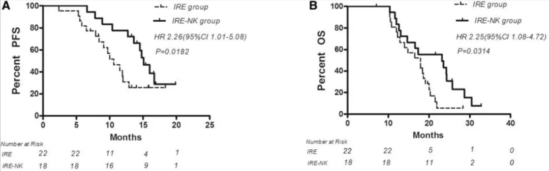 肝癌免疫疗法两大重大进展:NK生存率提升11%,CAR-T创8年生存奇迹